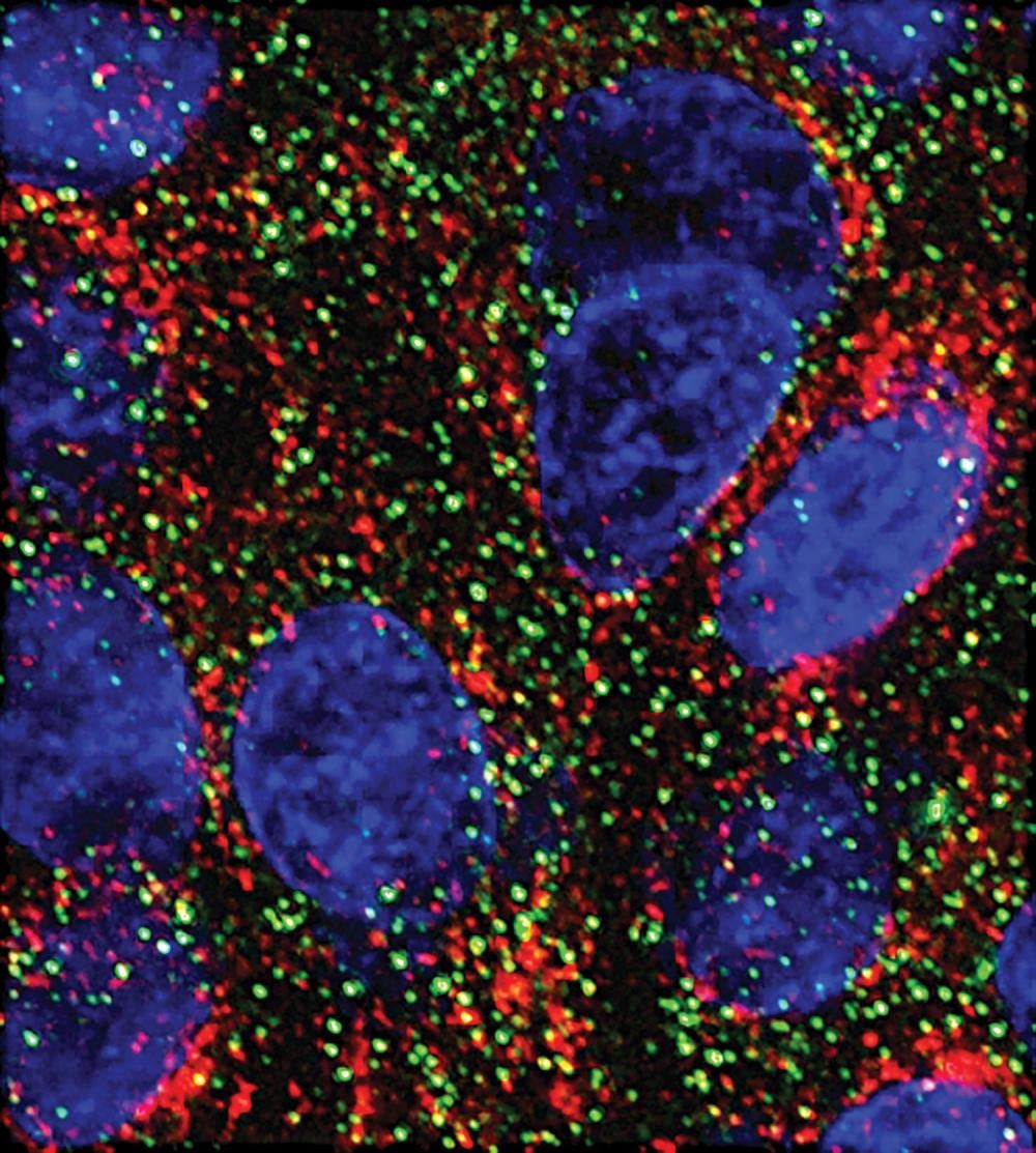 Dos microARN frenan el crecimiento de células pancreáticas en un estudio de laboratorio